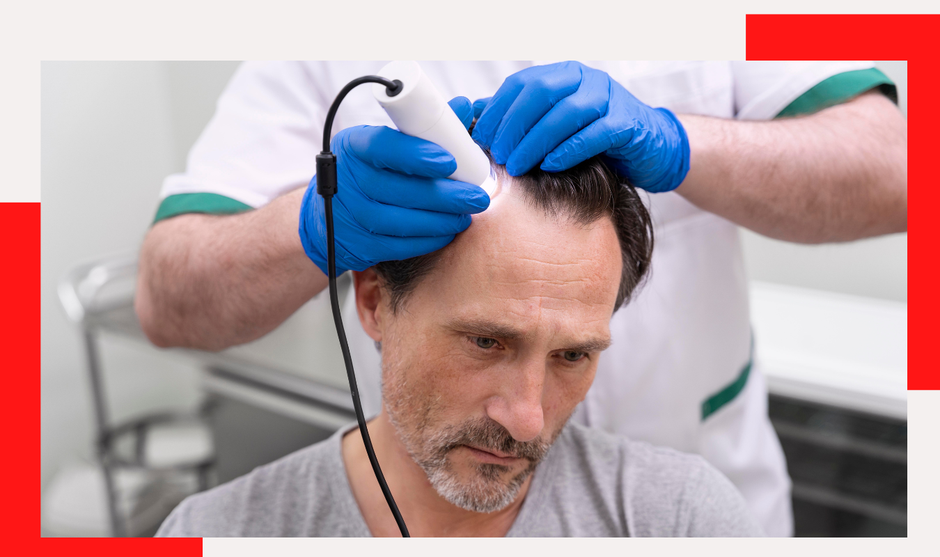 Dr. Pauls Best Hair Fall Treatment Doctor in Gurgaon