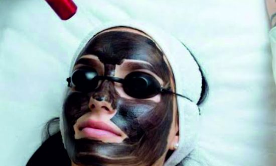 2-Carbon Laser Facial