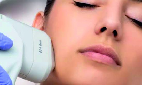 28-HIFU Treatment