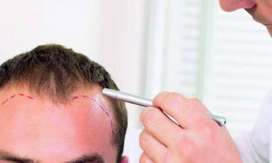 30-QR 678 Hair Regrowth Treatment