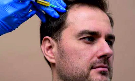 7-Hair PRP Treatment