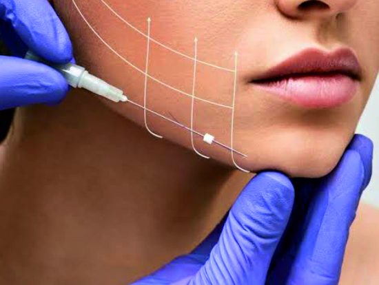 Thread face lift Thread face lift