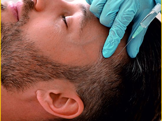 10-Hair Mesotherapy 10-Hair Mesotherapy
